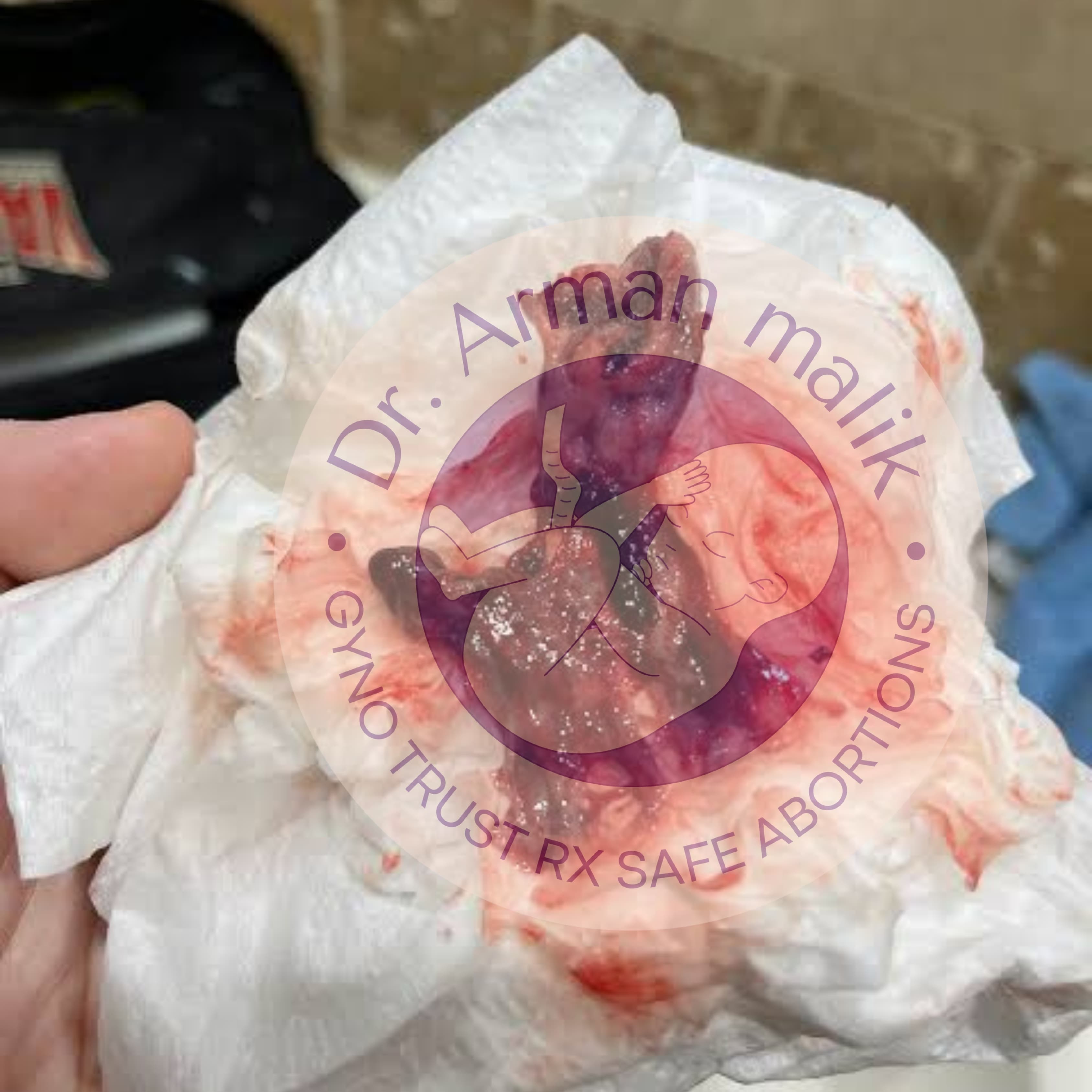 WhatsApp Image 2025-02-24 at 6.48.32 PM (1).jpeg